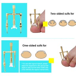 Dụng Cụ Điều Chỉnh Móng Chân