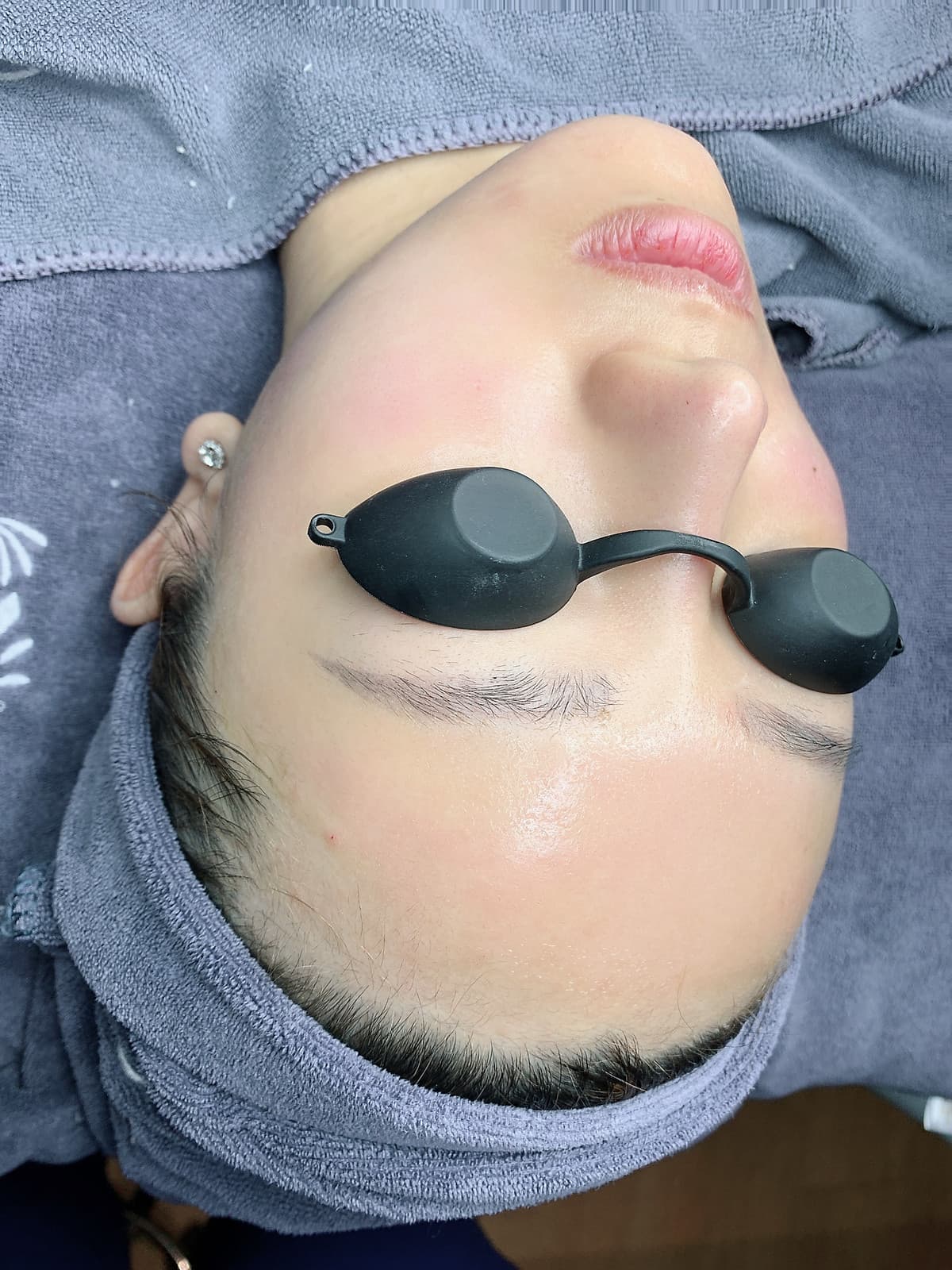 Gói glossy skin ( căng bóng da)_Q Beauty Spa