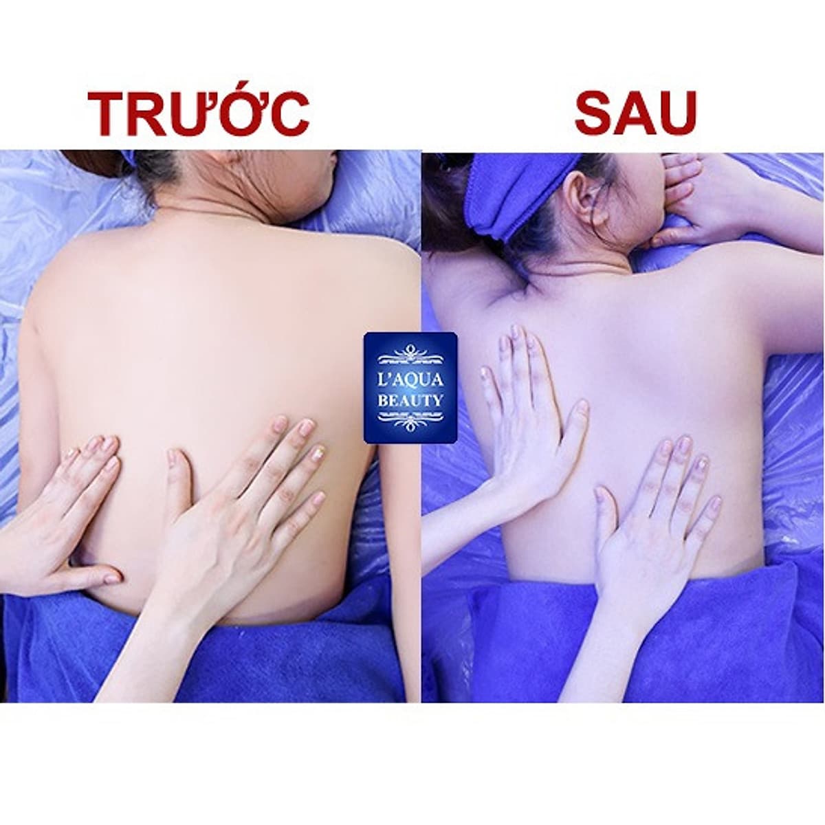 PHI THUYỀN HẤP TRẮNG DƯỠNG DA BODY VỚI TINH CHẤT NGỌC TRAI HÀN TẠI L’AQUA BEAUTY