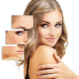 Việt Hàn Spa - Chăm Sóc Da Toàn Diện Trong 30 Ngày 07 Liệu Trình (Không Giới Hạn Số Lần Và Miễn Tip)