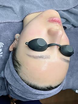 Gói glossy skin ( căng bóng da)_Q Beauty Spa