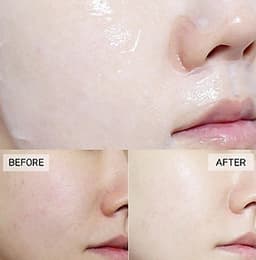Combo 10 Mặt nạ dưỡng da trắng sáng và làm đều màu da BNBG Vita Genic Whitening Jelly Mask (Vitamin C) 30ml x 10