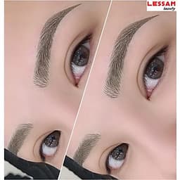 TRẺ HÓA LÀM SÁNG VÙNG NÁCH TẠI VIỆN THẨM MỸ LES SAM