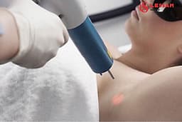 TRẺ HÓA LÀM SÁNG VÙNG NÁCH TẠI VIỆN THẨM MỸ LES SAM